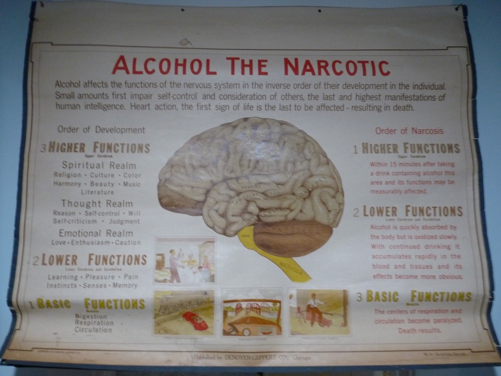 „ALCOHOL THE NARCOTIC“ 1930S PULL DOWN MEDICAL CHART , DENOYER GEPPERT 44X36