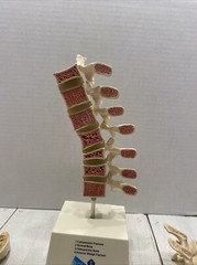 Drug Rep ACTONEL Dr’s Office Display
