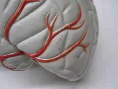 Seroquel Human Brain Anatomy Model w/ Clear Skull PharmaDesign Medical Display