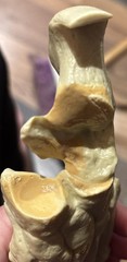 Anatomical foot display – Merck, Sharp & Dohme, please read