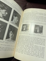 RARE Oral Surgery 1915 Illustrated Medical Dentistry Disease Truman W Brophy