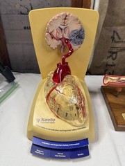 Pharmaceutical Drug Rep Doctors Office Heart Displays Xarelto