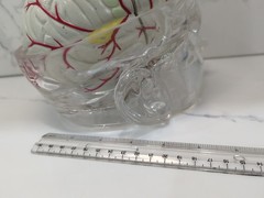Gliadel Human Brain Anatomy Model w/ Clear Skull PharmaDesign Medical Display
