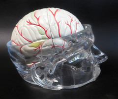 Head Skull Brain Model Seroquel Medical Pharmaceutical Lucite Medical Display