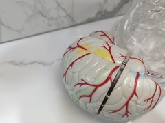 Gliadel Human Brain Anatomy Model w/ Clear Skull PharmaDesign Medical Display