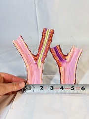 AEROBID Pharmaceutical Sales Promo Drug Rep Bronchial Tubes Model 2 Pc Medical
