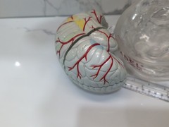 Gliadel Human Brain Anatomy Model w/ Clear Skull PharmaDesign Medical Display