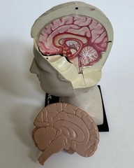 1974 Elavil MSD Merck Sharp Dohme Medical Head and Brain Advertising Display 8″