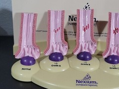 Vintage Nexium Doctor Pharmaceutical Display Erosive Esophagitis