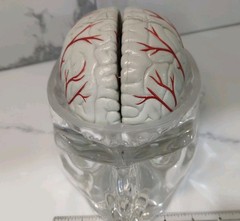 Gliadel Human Brain Anatomy Model w/ Clear Skull PharmaDesign Medical Display