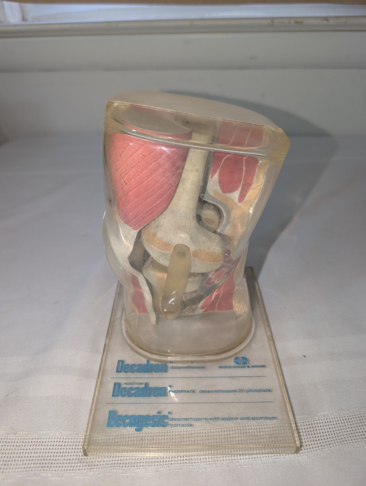 1960s Merck Pharmaceutical Advertising Model „Decadron“ Knee Model
