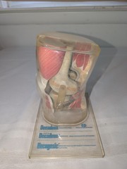 1960s Merck Pharmaceutical Advertising Model „Decadron“ Knee Model