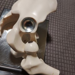 Hip Joint Model Advertising Indocin SR, Pharmaceutical Company Hand Out Doctors