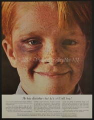 1962 Pharmaceutical Science Insulin Diabetes Research photo art decor vintage ad