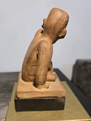 Vintage Pharmaceutical Advertising Figurine Valisone Cream Man With Skin Lesions