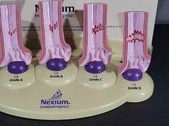Vintage Nexium Doctor Pharmaceutical Display Erosive Esophagitis