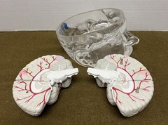 Seroquel Brain Model Pharmaceutical Advertising Display Research