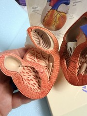 Heart Anatomy Display-drug Advertising-brevibloc-oddity