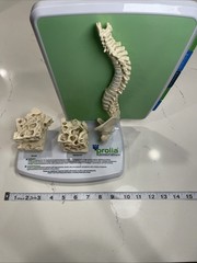 Prolia (Denosumab) Injection Pharmaceutical Model Advert For Doctors Office