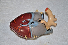 1960’s Merck Sharp Dohme Aldomet Heart Model Pharmaceutical Ad Methyldopa MSD