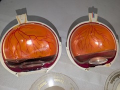 1960s Merck Pharmaceutical Advertising Model „Aldomet Methyldopa“ Eye Model