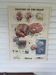 Rare Vintage ADDERALL Shire 3D Anatomy of the Brain Pharmaceutical Medical Chart