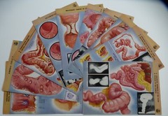 18 Ciba Pharmaceutical Folders w/ Color Plates – Pathology Anatomy War Injuries