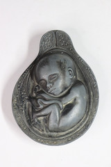 VTG Tabron Metal Paperweight Salesman Sample Gift Fetal Baby Parke-Davis (s824)