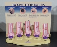 Vintage Nexium Doctor Pharmaceutical Display Erosive Esophagitis