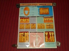 Vintage ANACIN Tablets WHITEHALL Laboratories ADVERTISING Dentist DENTAL POSTER