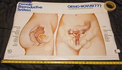Vinatge 1986 Female Reproductive System ORTHO-NOVUM 777 20×34 Poster ORTHO…