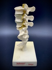 Rare Geigy Voltaren Medical Advertising Spine Model – Anatomical Lumbar/Sacrum