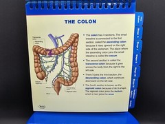 NIB Roche Pharmaceutical Xeloda Colon Cancer Anatomical Model & Chart Display