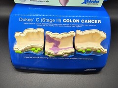 NIB Roche Pharmaceutical Xeloda Colon Cancer Anatomical Model & Chart Display