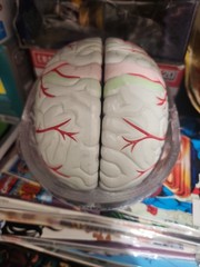 Seroquel Human Brain Anatomy Model w/ Clear Skull PharmaDesign Medical Display