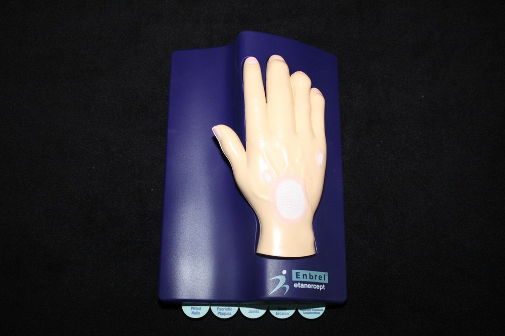 Drug Rep Enbrel Psoriasis Hand Muscles Bones Ligaments Anatomical Model Anatomy