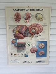 Rare Vintage ADDERALL Shire 3D Anatomy of the Brain Pharmaceutical Medical Chart
