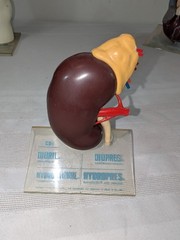 1960s Merck Pharmaceutical Advertising Model „Hydrodiuril Hydropres“ Model