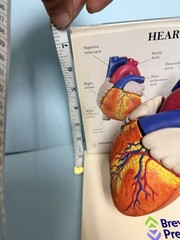 Heart Anatomy Display-drug Advertising-brevibloc-oddity