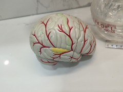 Gliadel Human Brain Anatomy Model w/ Clear Skull PharmaDesign Medical Display