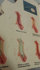 Heart Book Patient Guide to the Human Heart Transderm Nitro Advertising Medical