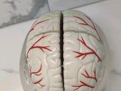 Gliadel Human Brain Anatomy Model w/ Clear Skull PharmaDesign Medical Display