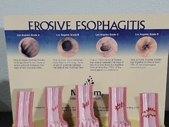 Vintage Nexium Doctor Pharmaceutical Display Erosive Esophagitis