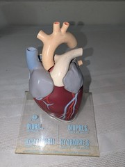 1960s Merck Pharmaceutical Advertising Model „Hydrodiuril Hydropres“ Model