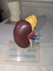 1960s Merck Pharmaceutical Advertising Model „Hydrodiuril Hydropres“ Model