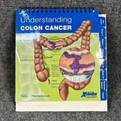 Colon Cancer Anatomical Anatomy Model Chart Display Roche Pharmaceutical Xeloda