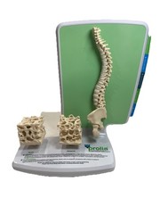Prolia (Denosumab) Injection Pharmaceutical Model Advert For Doctors Office