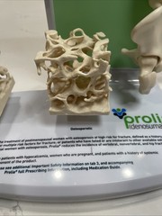 Prolia (Denosumab) Injection Pharmaceutical Model Advert For Doctors Office