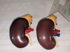 1960s Merck Pharmaceutical Advertising Model „Hydrodiuril Hydropres“ Model