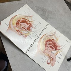 1975 Eli Lilly Pharmaceutical Medical Illustrations Of Surgical Anatomy Macabre